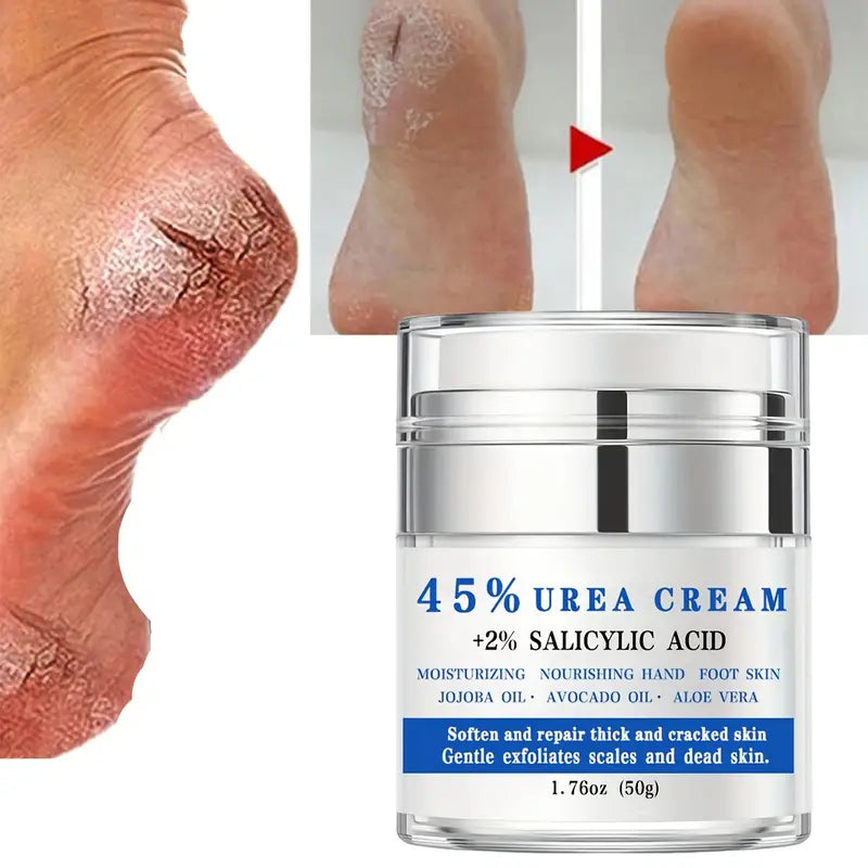 1.06oz,45% Urea + 2%Salicylic Acid Foot Cream,Pump Foot Moisturizer For Dry Rough Crack Skin,Softening And Repairing Thick And Cracked Skin,Exfoliating Scales And Dead Skin